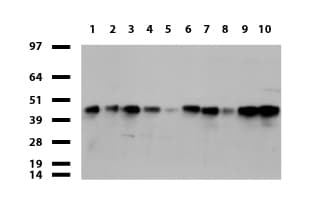 Monoclonal Mouse anti-Human CD32A Antibody (clone UMAB59, IHC, WB)
