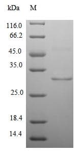 Mouse PDK3 Protein (Recombinant 6His, N-terminus)