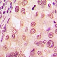 NR3C1/Glucocorticoid Receptor Antibody