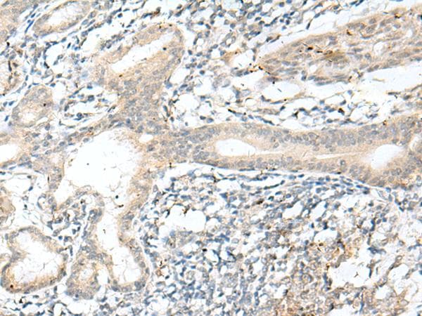 NXNL1 / TXNL6 Antibody