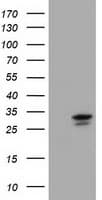 UCK1 Antibody (clone OTI6H7)