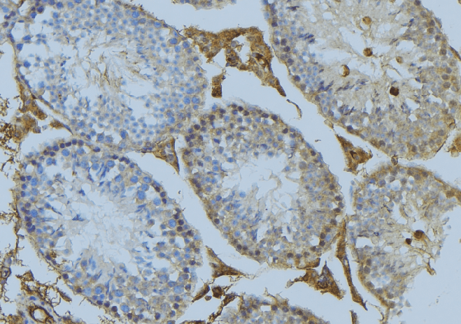 Polyclonal Rabbit anti-Human CEP78 / IP63 Antibody (IHC, IF, WB)