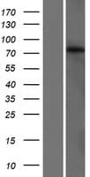 GLB1L3 Protein (Over-Expression Lysate Myc-DDK (Flag))