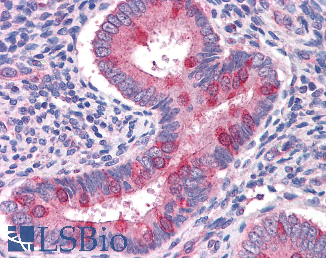 IHC-plus™ Hamartin / TSC1 Antibody (aa1150-1163)