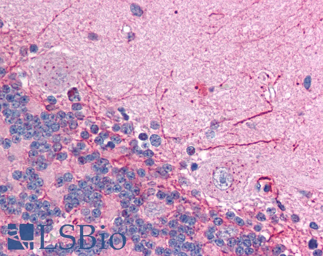 GABRP Antibody (aa28-77)