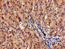 Polyclonal Rabbit anti-Human ANPEP / CD13 Antibody (IHC, IF, WB)
