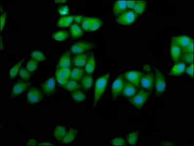 PathPlus™ RPE65 Antibody