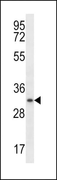 Polyclonal Rabbit anti-Human MYOG / Myogenin Antibody (aa1-30, WB)