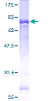 Human TCN2 Protein (Recombinant GST)