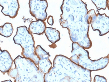 CD71 / Transferrin Receptor Antibody (clone TFRC/1839)