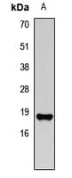 ACP1 / Acid Phosphatase Antibody