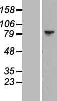 LIMK2 Protein (Over-Expression Lysate Myc-DDK (Flag))