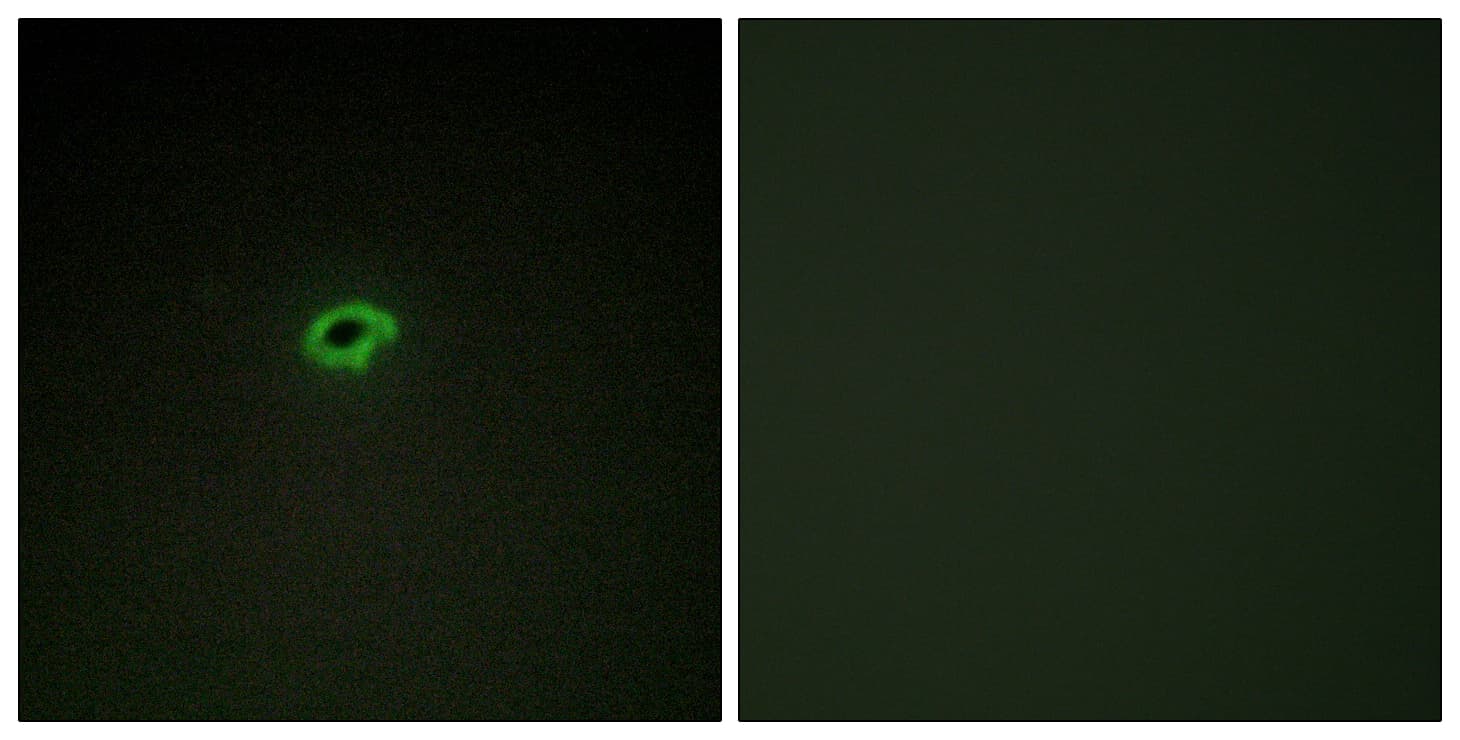 COL4A4 / Collagen IV Antibody (aa541-590)