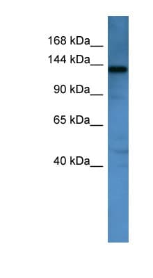 AFF1 / AF4 Antibody (N-Terminus)