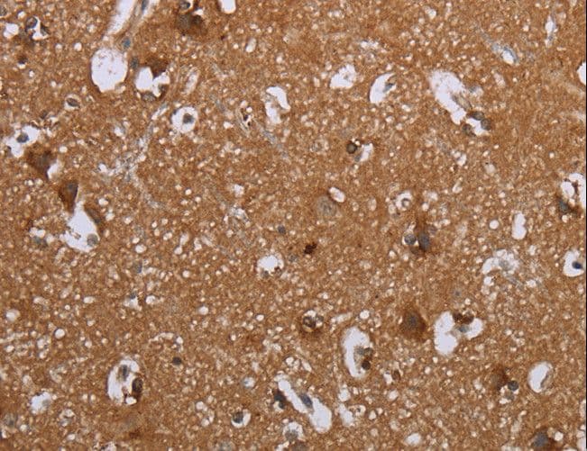 LIMK1 / LIMK Antibody