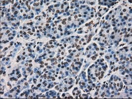 Monoclonal Mouse anti-Human MKI67 / Ki67 Antibody (clone OTI3D11, IHC, WB)