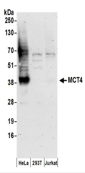SLC16A3 Antibody (aa400-450)