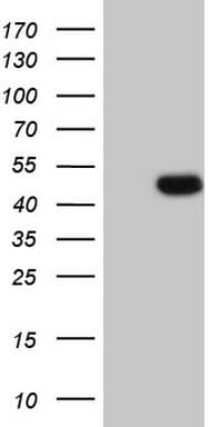 WTAP Antibody (aa2-106, clone OTI2C4, Carrier-free)