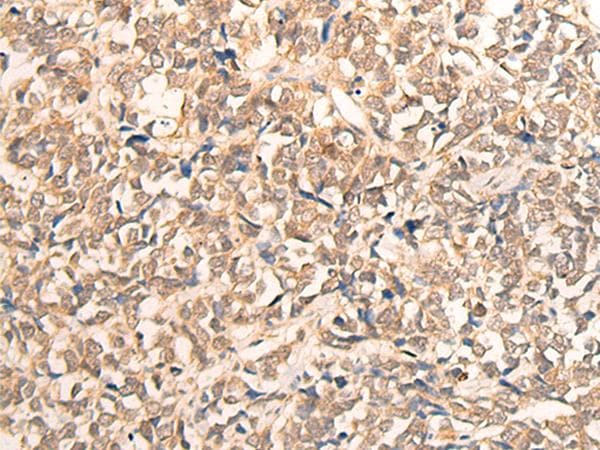 CPS1 Antibody