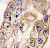 CD8A / CD8 Alpha Antibody (aa150-180)