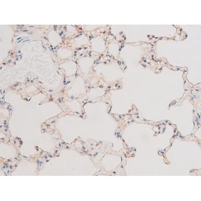 LIMK2 Antibody (phospho-Ser283)