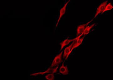 F13A1 / Factor XIIIa Antibody