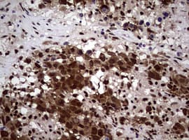 Monoclonal Mouse anti-Human NBN / Nibrin Antibody (clone OTI8E7, IHC, WB)