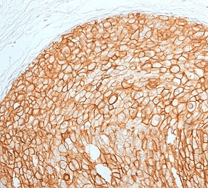 ERBB2 / HER2 Antibody (clone 2KRI7-2)
