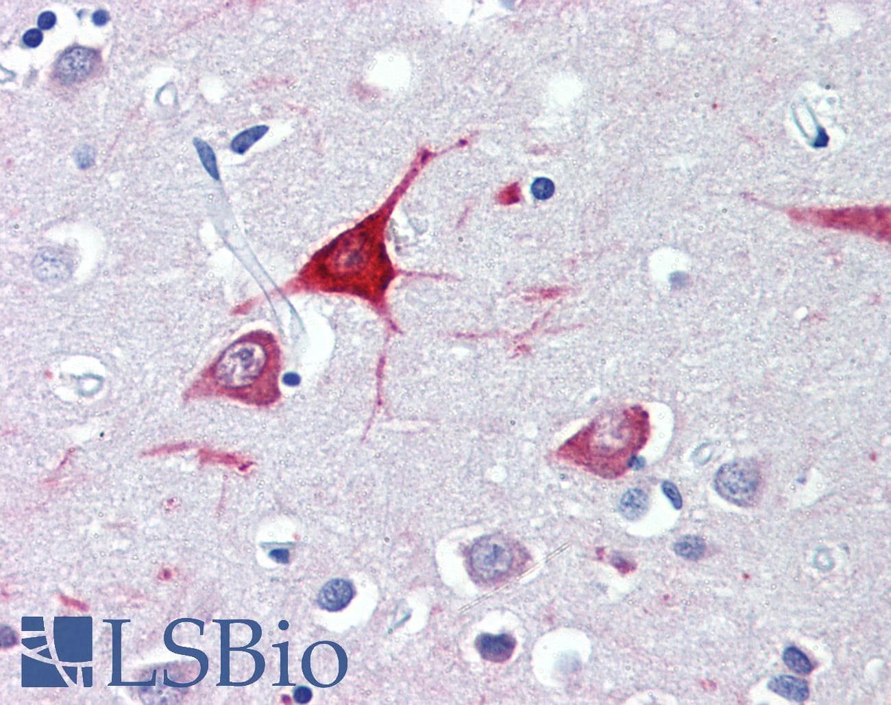 IHC-plus™ USP9X / FAM Antibody (aa2479-2492)