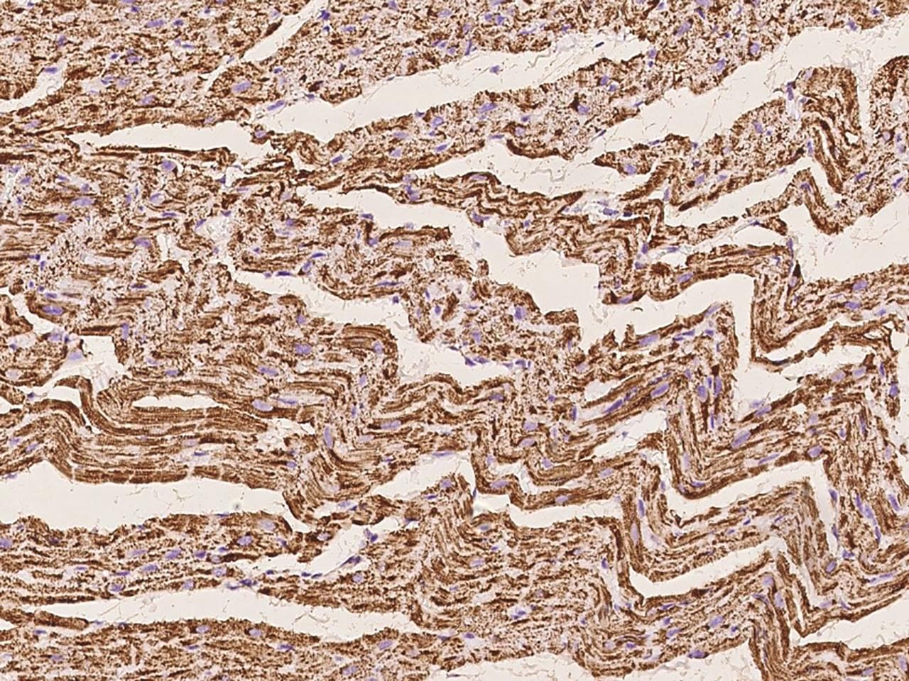 Polyclonal Rabbit anti-Human ETFB Antibody (IHC, IF, WB)