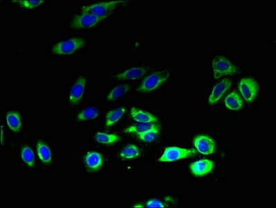Polyclonal Rabbit anti-Human SLC52A1 / GPR172B / PAR2 Antibody (IHC)