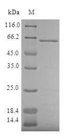 Human AKR7A3 Protein (Recombinant GST, N-terminus)