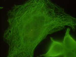 TUBB / Beta Tubulin Antibody