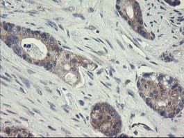 Monoclonal Mouse anti-Human GORAB / SCYL1BP1 Antibody (clone OTI1E3, aa35-394, IHC, WB)