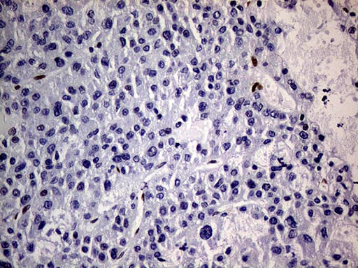 MEIS1 Antibody (aa176-390, clone OTI2A3)
