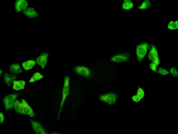 IHC-plus™ PHGDH Antibody (clone 4A3-1D6)