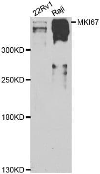 MKI67 / Ki67 Antibody