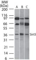 IHC-plus™ Polyclonal Rabbit anti-Human SIRT5 / Sirtuin 5 Antibody (aa30-46, IHC, WB)