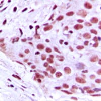 Polyclonal Rabbit anti-Human MCM2 Antibody (N-Terminus, IHC, IF, WB)