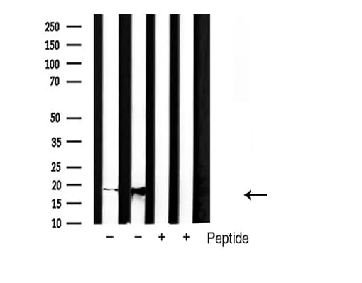 Polyclonal Rabbit anti-Human SOD1 / Cu-Zn SOD Antibody (WB)
