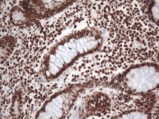 EWSR1 / EWS Antibody (aa256-447, clone OTI2B3)