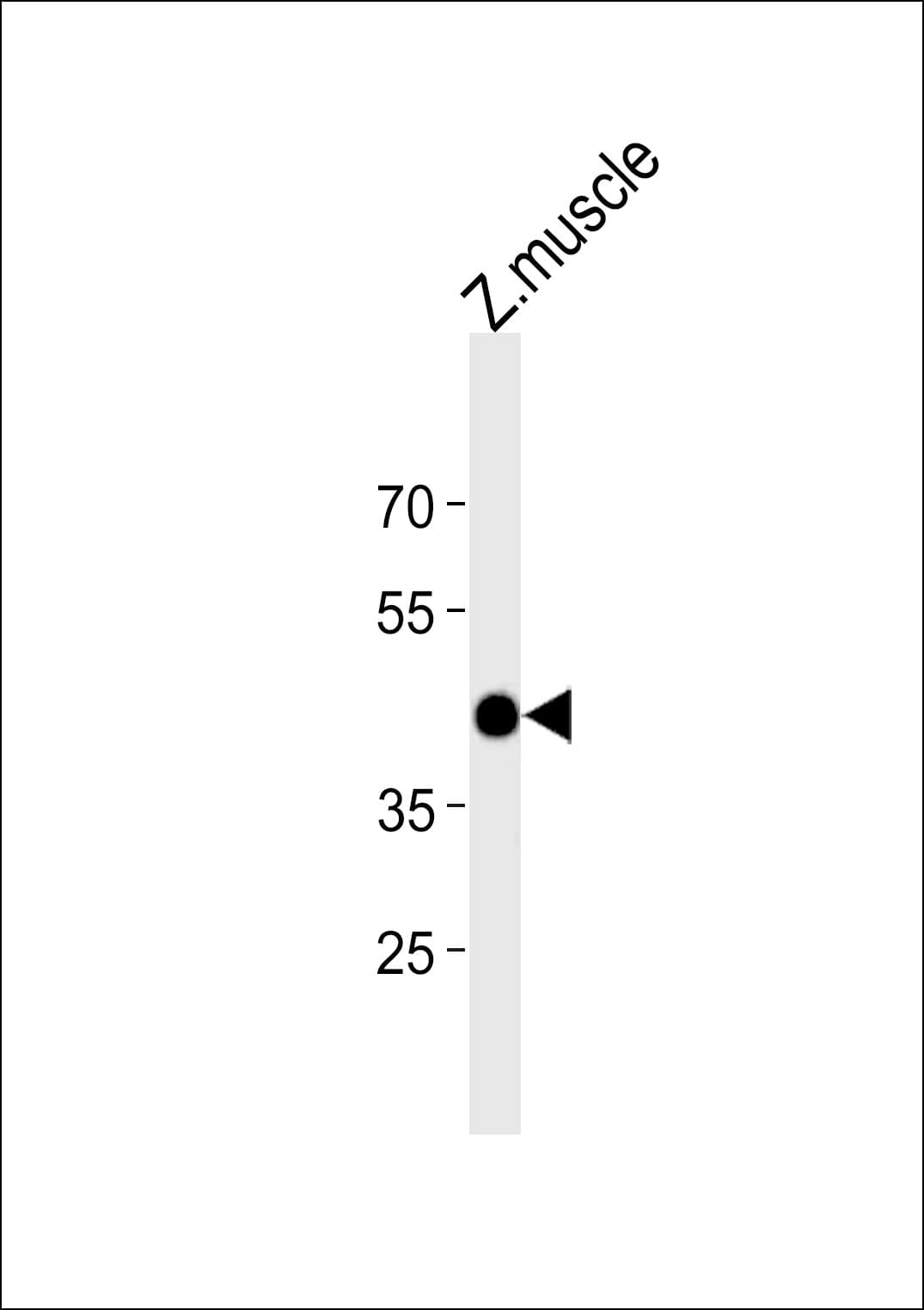 ATF4 Antibody (aa288-314)