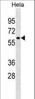 Polyclonal Rabbit anti-Human ZNF410 Antibody (aa448-477, WB)