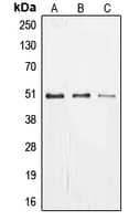 ZIF268 / EGR1 Antibody (C-Terminus)