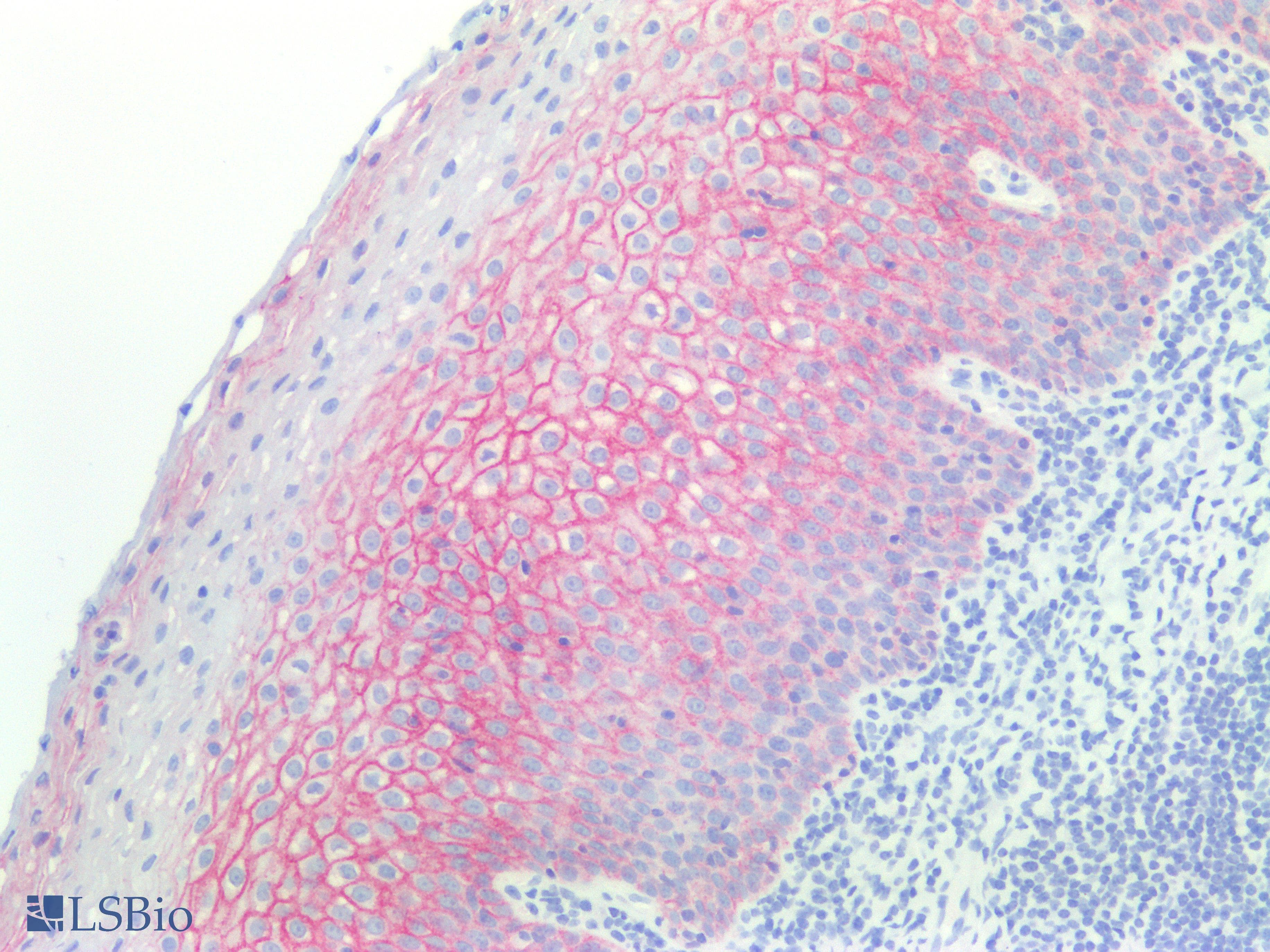 IHC-plus™ Monoclonal Mouse anti-Human DSG3 / Desmoglein 3 Antibody (clone 6G2C11, IHC, WB)
