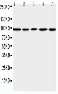 Polyclonal Rabbit anti-Human MCM6 Antibody (aa589-605, IHC, WB)
