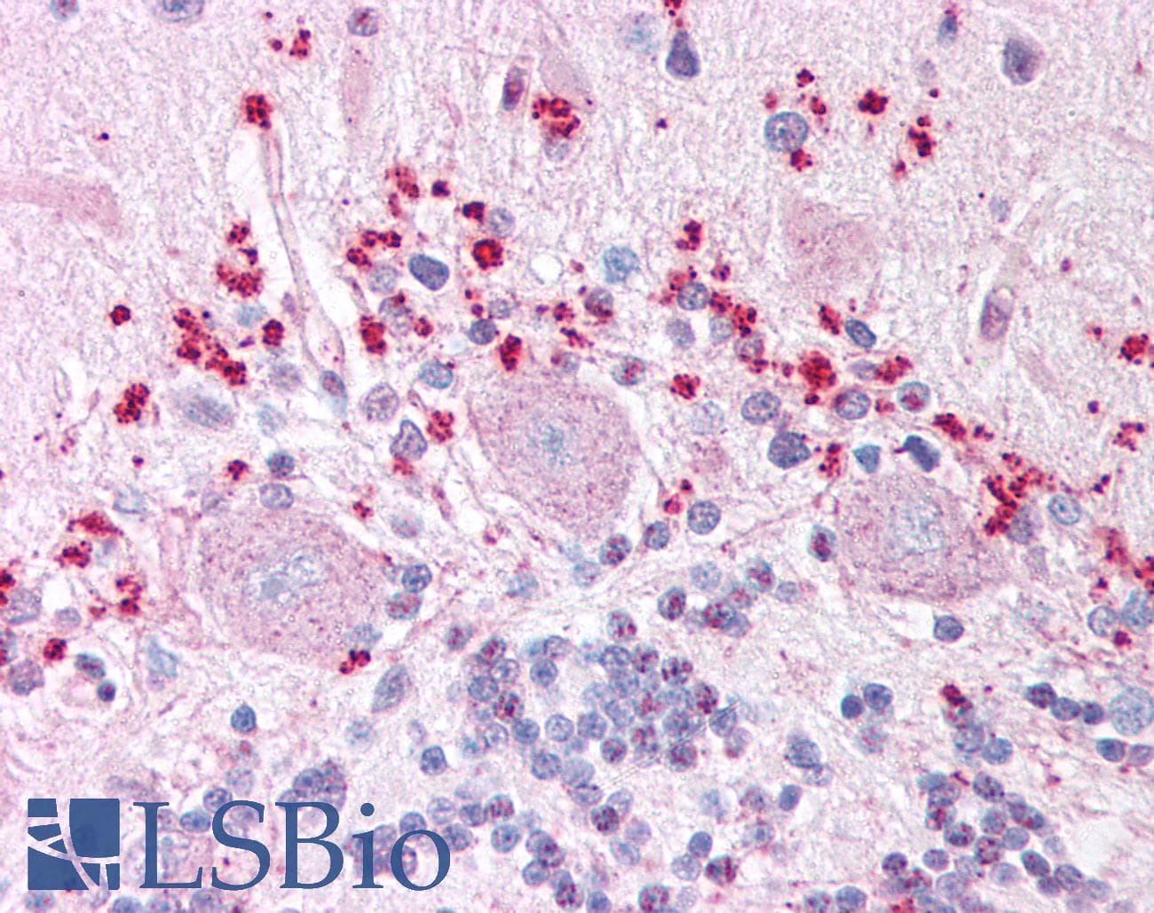 IHC-plus™ Polyclonal Rabbit anti-Human WNT7A Antibody (Internal, IHC)