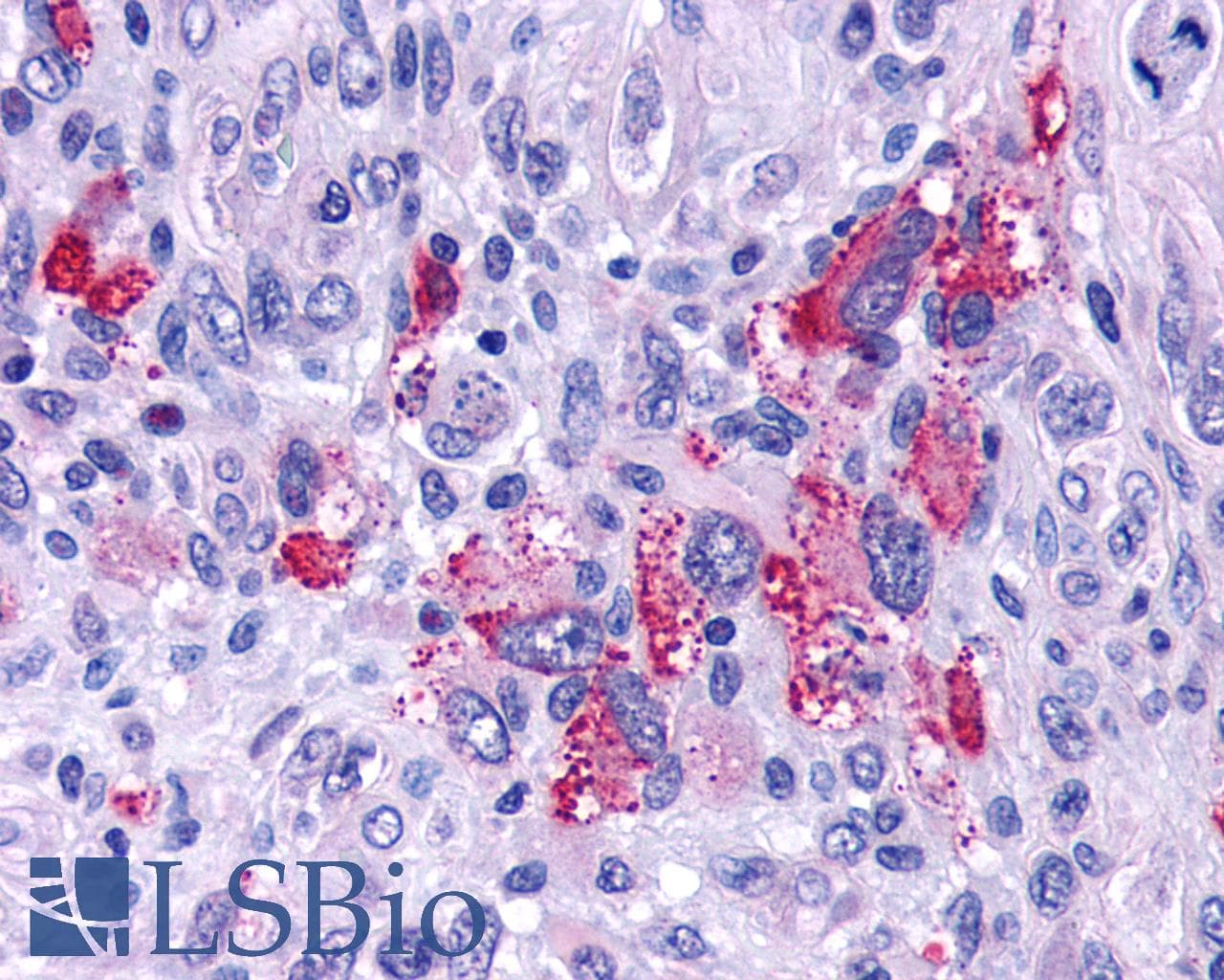 PathPlus™ GPR162 Antibody (Extracellular Domain)