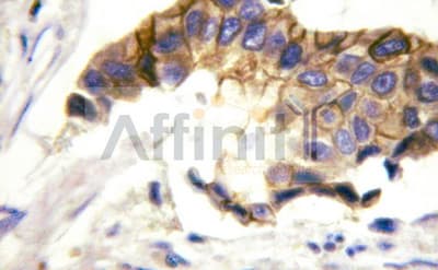 Polyclonal Rabbit anti-Human INSR / Insulin Receptor Antibody (IHC, IF, WB)
