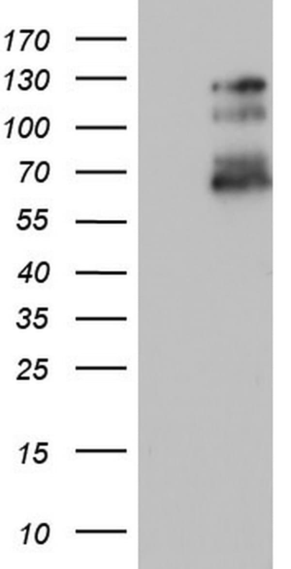 Monoclonal Mouse anti-Human GLI / GLI1 Antibody (clone OTI1B1, aa755-1106, WB)